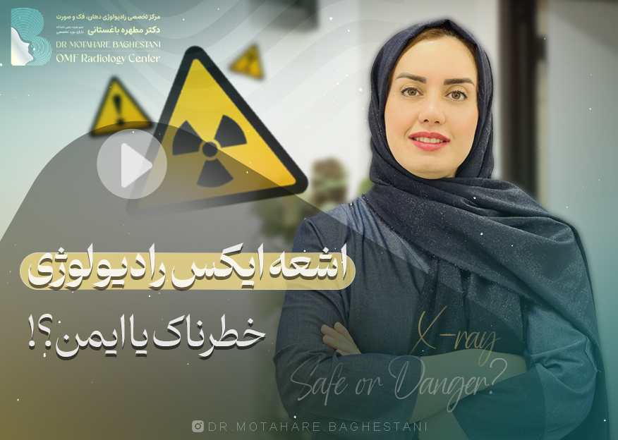 آیا اشعه ایکس رادیولوژی خطرناک است؟